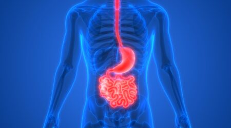 Eosinophilic Esophagitis